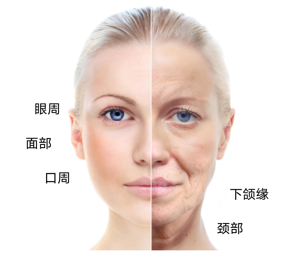 赛诺秀5D胶原光