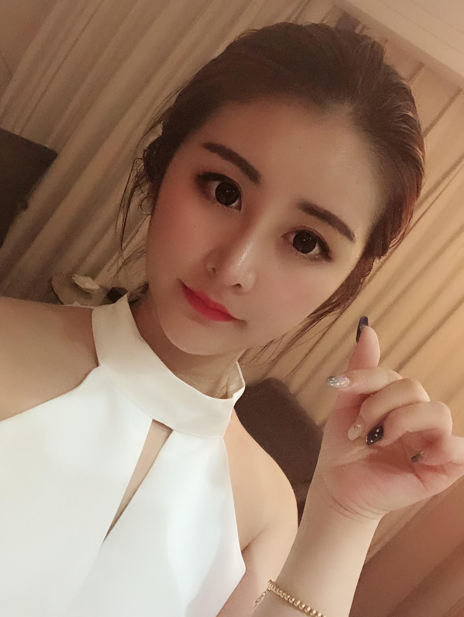 烟台曙光整形医院玻尿酸隆鼻